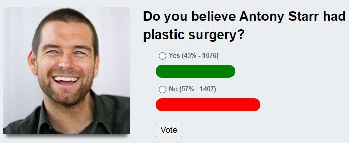 Antony Starr plastic surgery poll