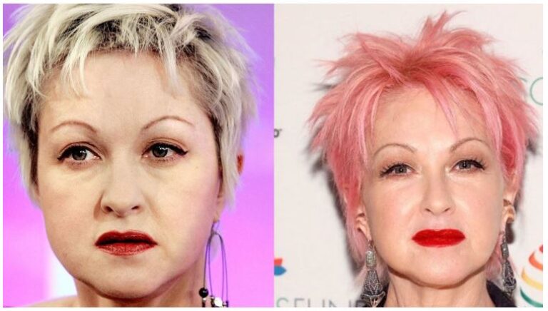 Cyndi Lauper S Plastic Surgery Isn T Fearful Of Getting Old