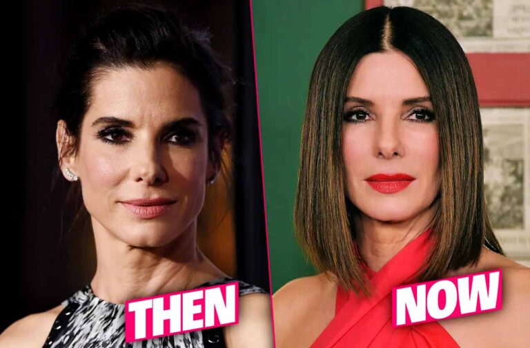 Sandra Bullock's plastic surgery rumors - before and after photos