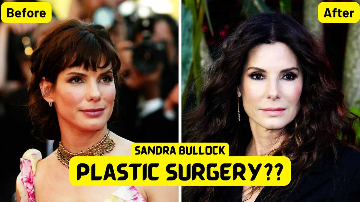 Sandra Bullocks Plastic Surgery Rumors Before And After Photos