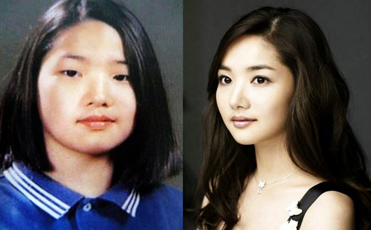 Park Min Young's photo before and after plastic surgery