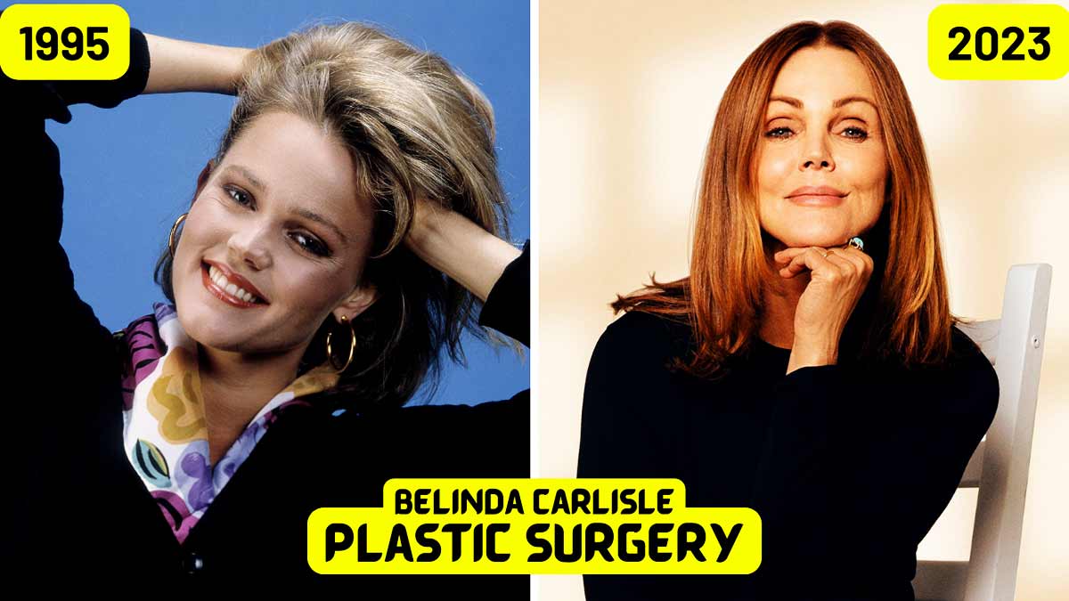 Belinda carlisle plastic surgery