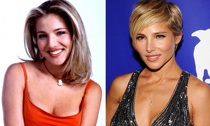 Elsa Pataky's nose job