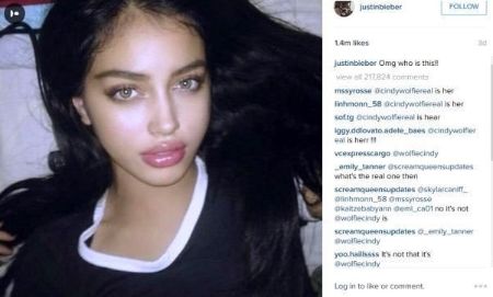 Justin shared Cindy Kimberly's plastic surgery photo