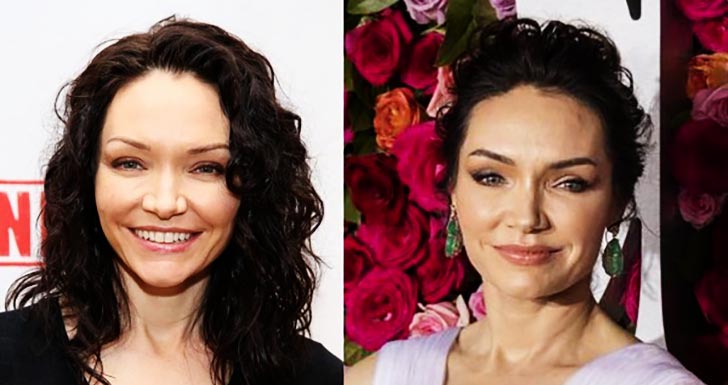 Katrina Lenk Botox before and after