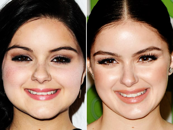 Ariel Winter before and after plastic surgery