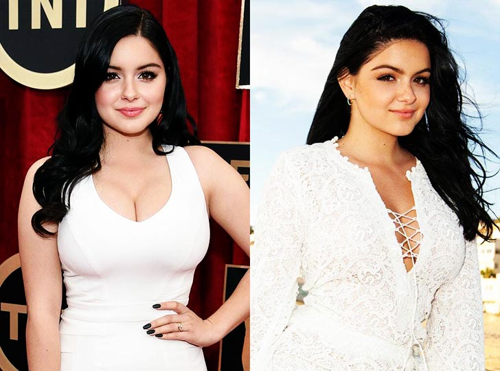 Ariel Winter had breast reduction surgery