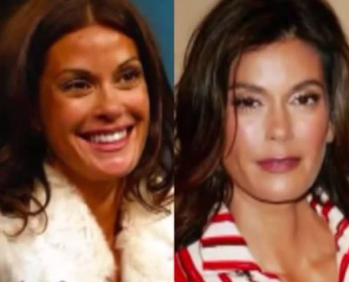 Teri Hatcher's before and after rumored plastic surgery