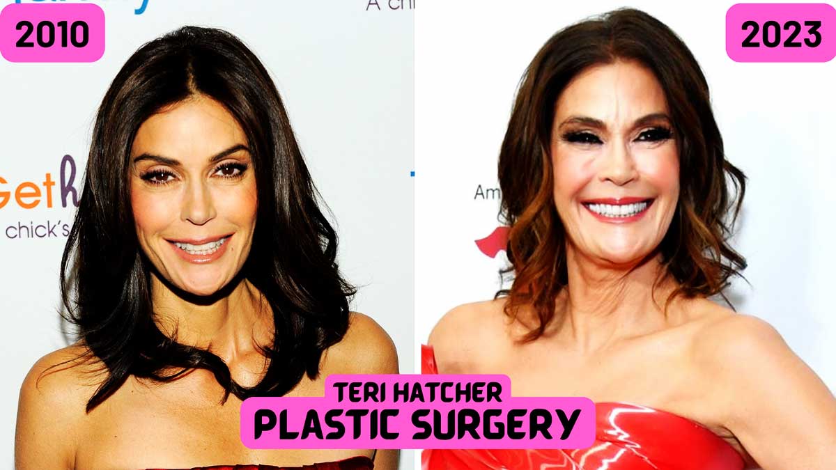 housewives teri hatcher breast implant Porn Photos
