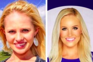 Tomi Lahren's Plastic Surgery Rumors - Stays Mum When Asked!