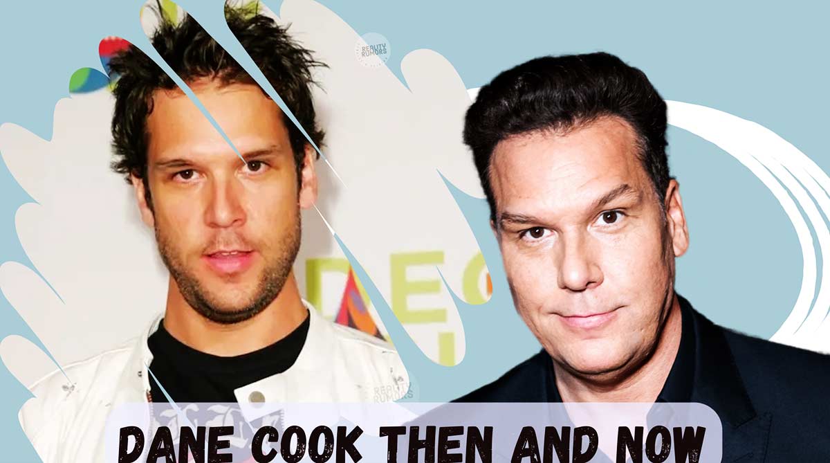 Dane cook before and after plastic surgery