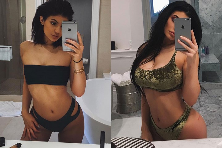 Has Kylie Jenner had boob job