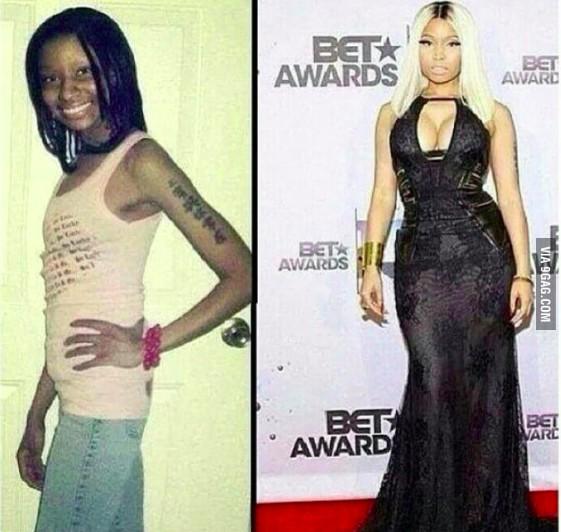 Nicki Minaj before and after plastic surgery