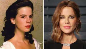 Kate Beckinsale's plastic surgery - denies having Botox and fillers